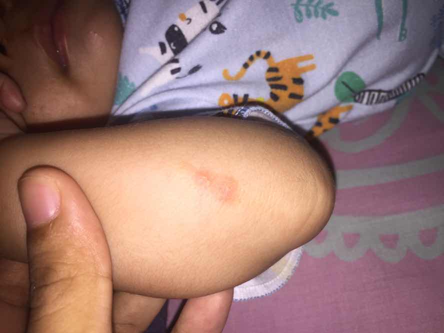 Ini luka karna apa ya?