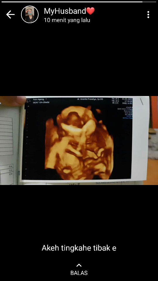 Putri ageng damar wangsa profile icon