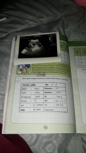 ada yang ngalamin sama gak bun?