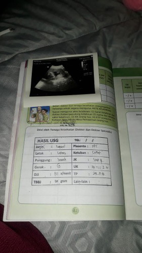 ada yang ngalamin sama gak bun?