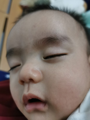 ฉีดวัคซีน