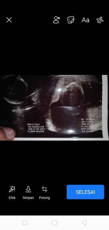 Sekarang berapa week y bun..