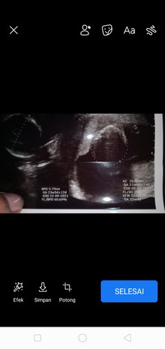 Sekarang berapa week y bun..