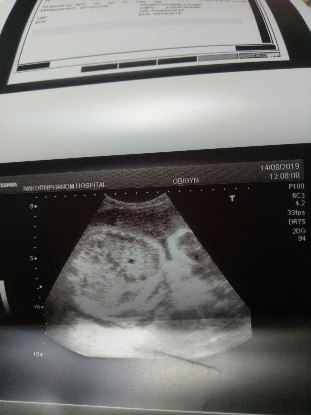 อยากทราบเพศคะ