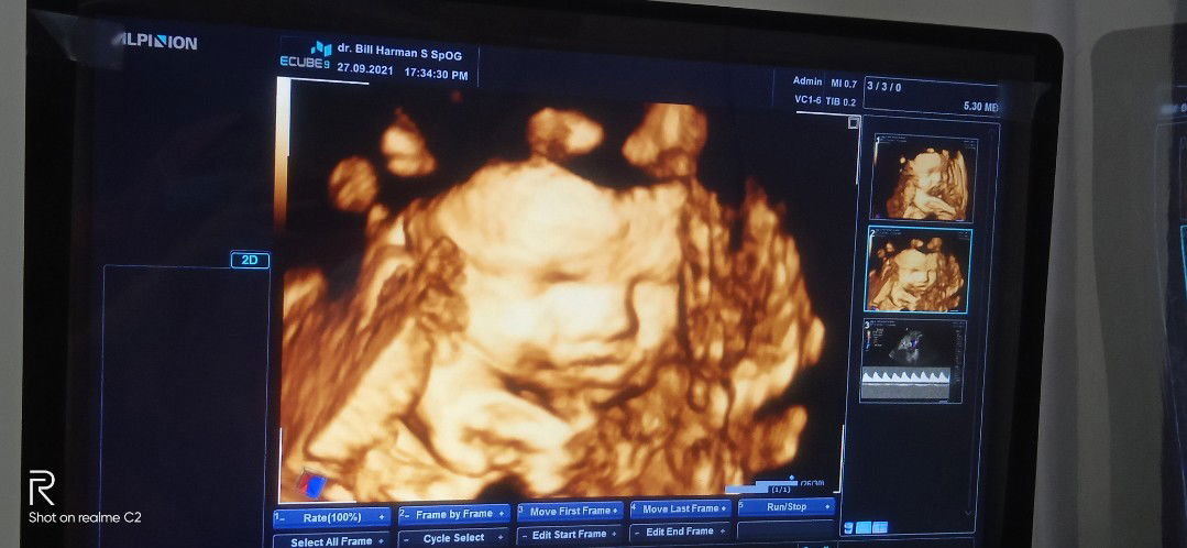 Syarifah profile icon