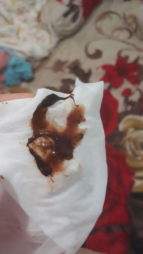 kontraksi + lendir merah