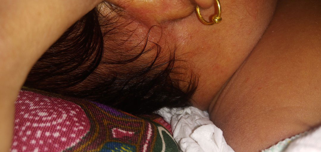 Kulit Kepala, Wajah, dan Badan Bayi