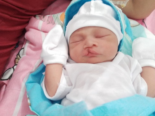 From 1cm to 10cm real quick