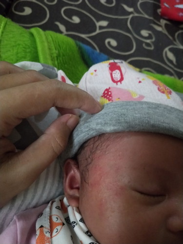 bayi umur 24 hari