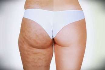 Sore Bunda mohon solusinya