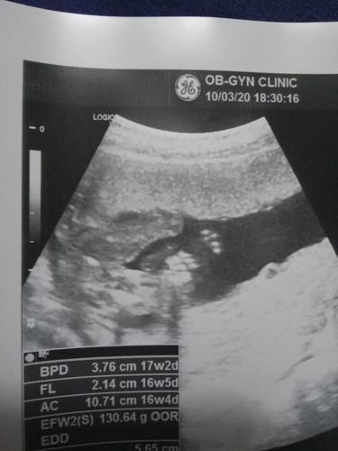 ซาวด์เพศลูก