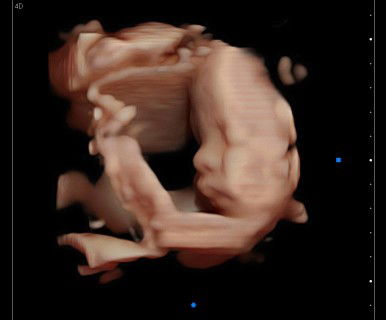 Dormian Nainggolan profile icon