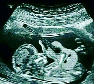 Mau tanya, kalo perut sakit saat hamil kenapa yaa?bahaya juga gak untuk kesehatan bayi ku?