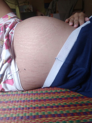 ตั้งครรภ์30w ท้อง2