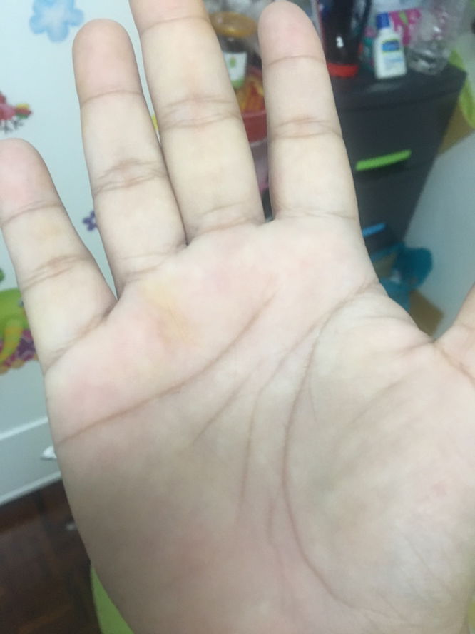 สอบถามหน่อยค่ะ ต้องหาหมอไหมคะ