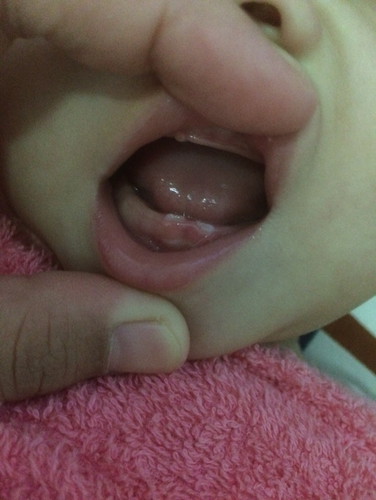 แปรงฟันให้ลูก