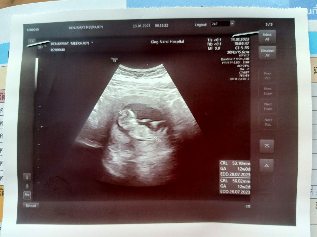 Benjamat Meeprajun profile icon