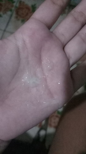 มีมูกใสเเบบนี้ออกมาเเต่ใม่มีอาการปวดเลย