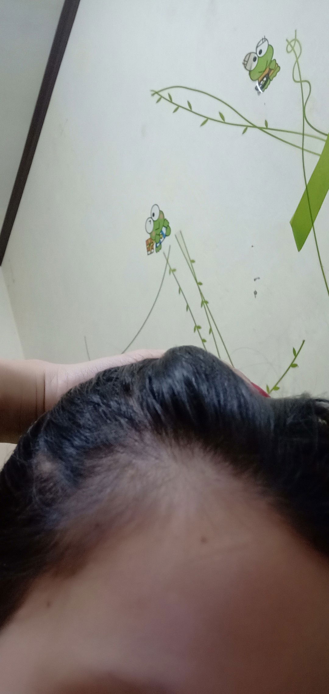 rambut rontok saat hamil