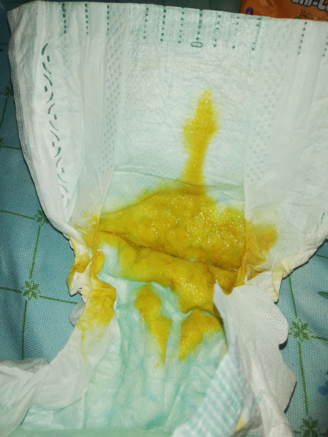 Is This Good Or Bad?