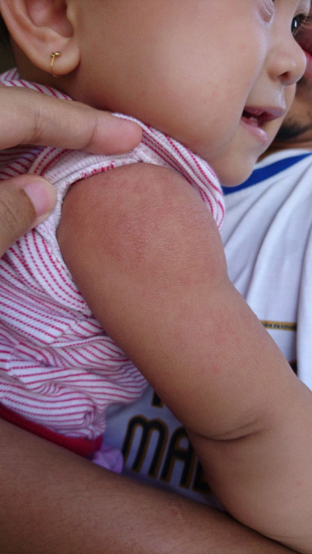 Ini Biang Keringat Apa Bukan Ya ?