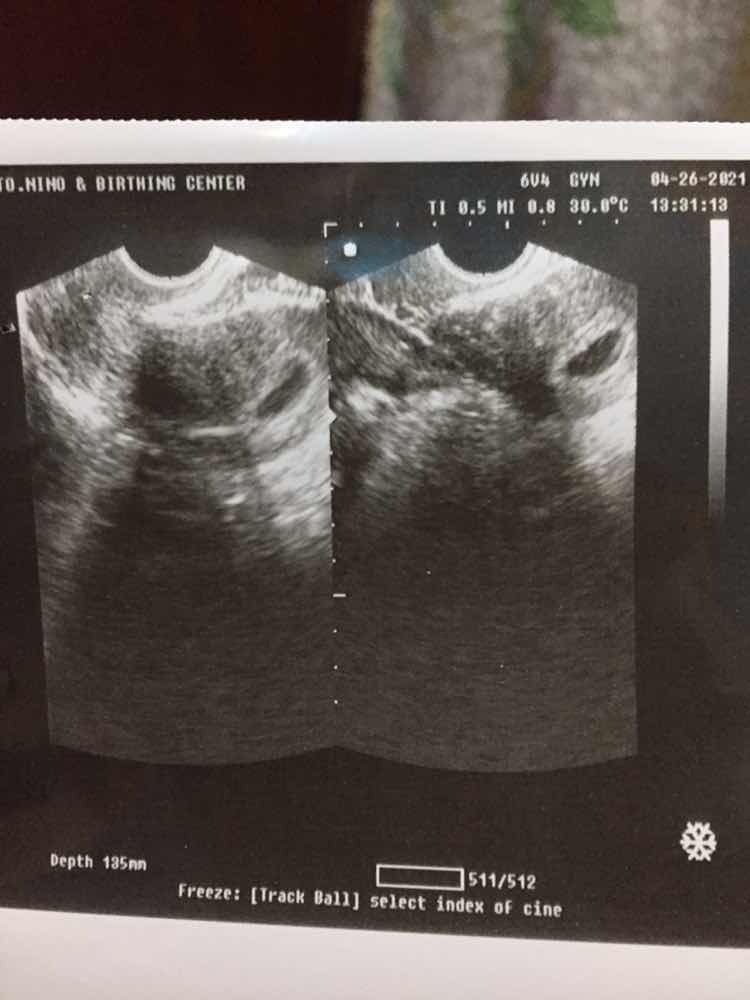 Jiamie Sumalinog profile icon