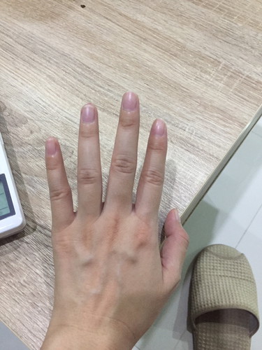 แม่ท่านไหนมีอาการมือ-เท้าบวมแล้วบ้าง