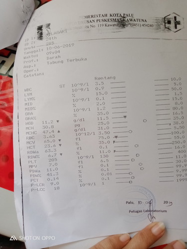Adha yg bisa tolong Artikan ini?