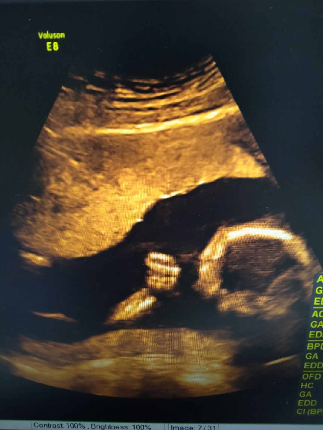 Taddy Chanana profile icon