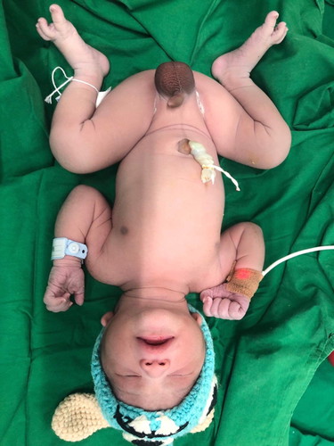 แชร์ประสบการณ์