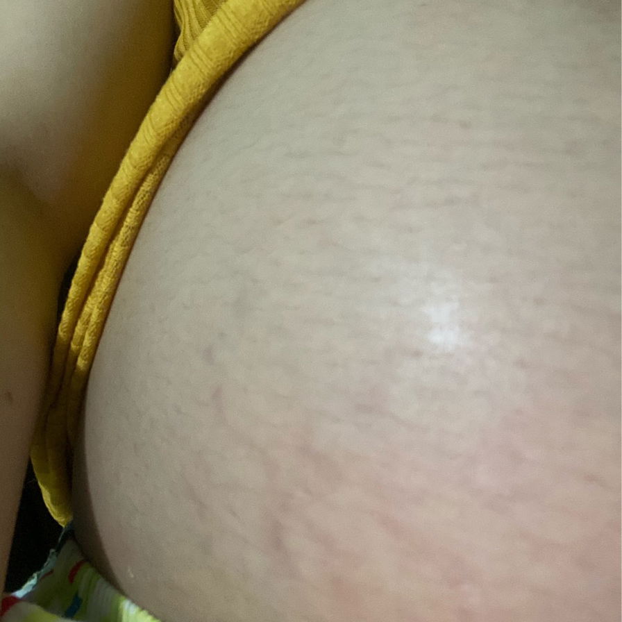 32w3d có phải rạn da?