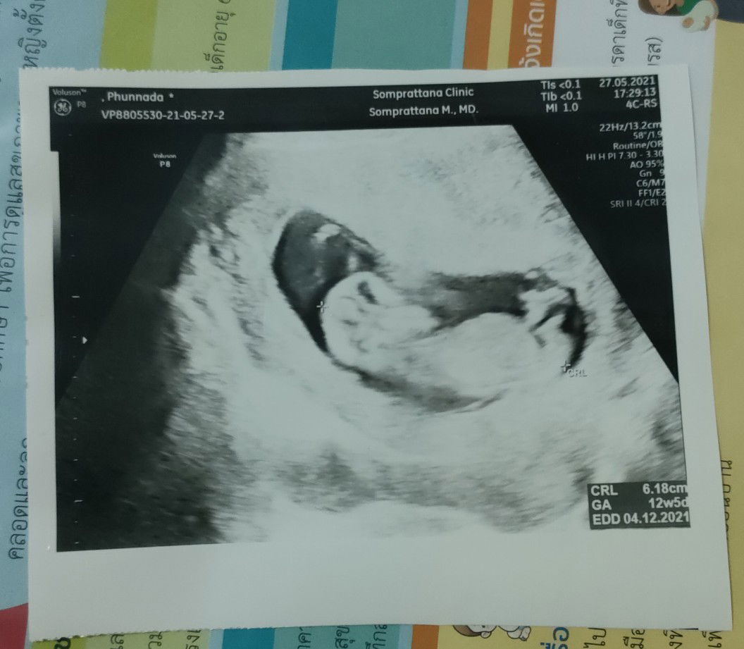 เจ้าตัวเล็ก profile icon