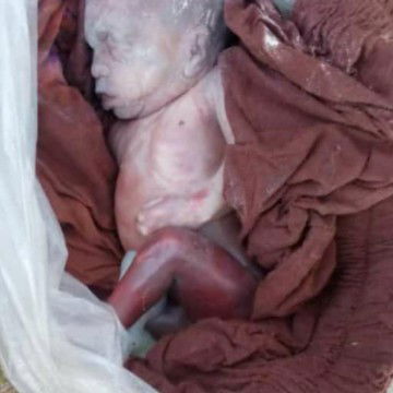 bayi yang di buang oleh seorang ibu