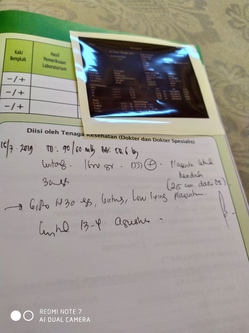 Low Lying (Plasenta Rendah)