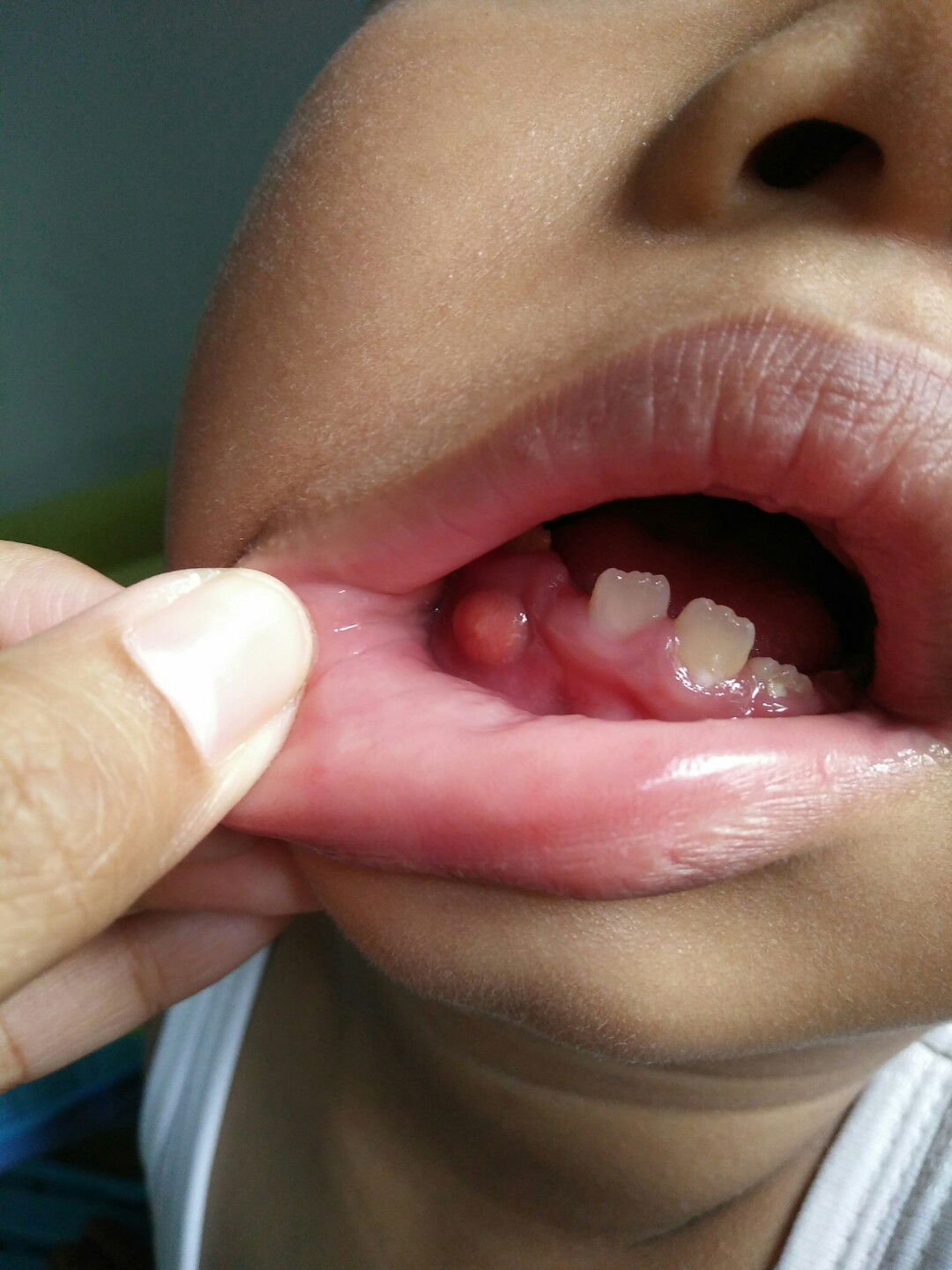 ini hrs di apain yaa