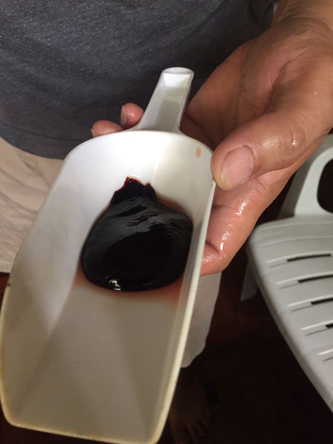 Blood clot b ito? Sino nka experience ng ganito.