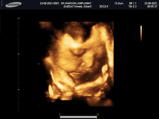 Onanong profile icon