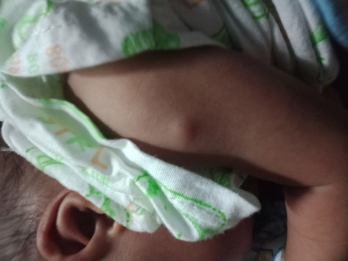 อยากรุ้ว่าน้องเปนอะไรหรือป่าว