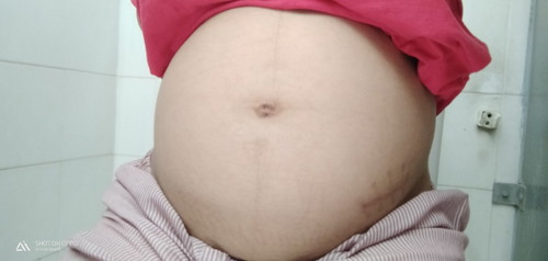 25พฤศจิกายน?