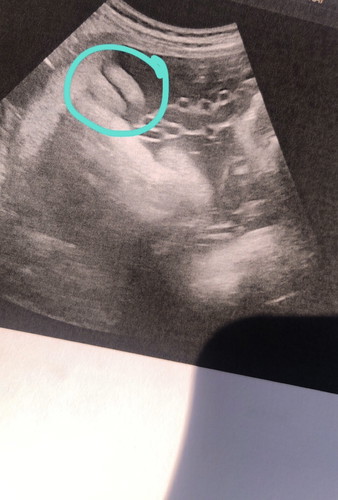 สอบถามคะ