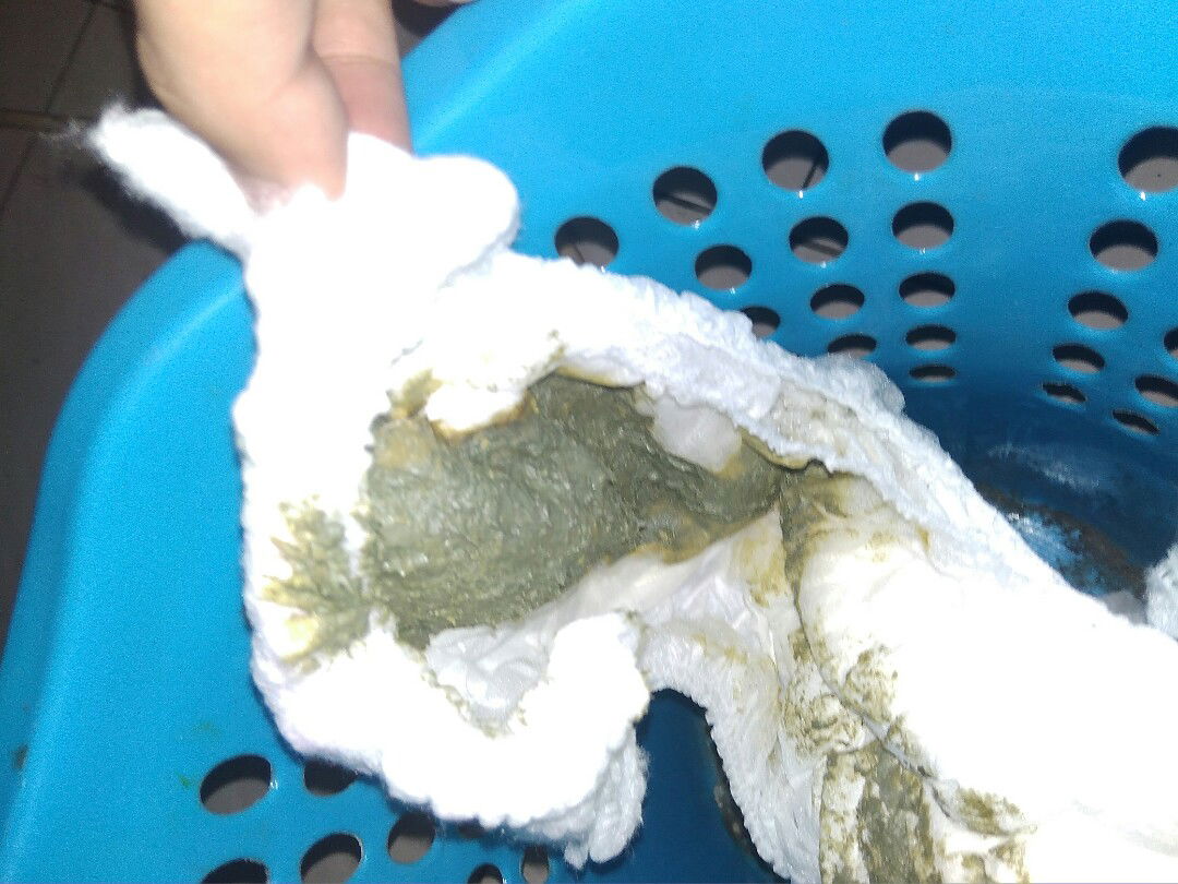 mohon maaf yang jijik jangan di liat ya bun