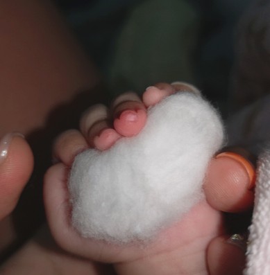 ตัดเล็บให้น้องแต่ดันไปตัดโดนเนื้อ