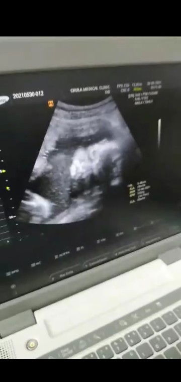 ?υี้ɭꦱՎԶ૦☮ profile icon