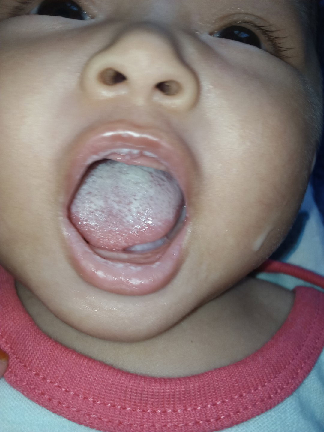 lidah putih