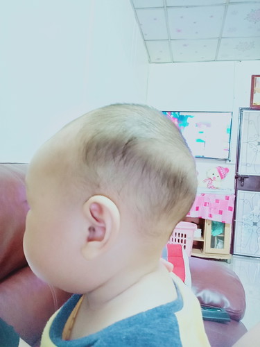 ลูกชายหัวกลมหรือแบน