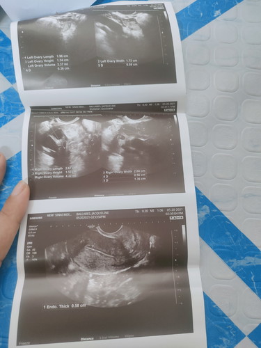 Done Check up..2 times na akong ngpatranvi.And for the second may follicle daw right Side Ng ovary .