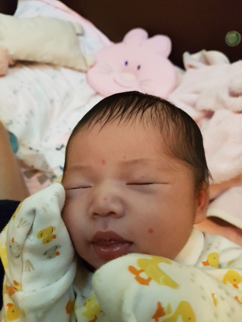 ลูกมีจุดแดงขึ้นที่หน้า ไม่นู่นจับแล้วดูเรียบๆ ลูกเป็นอะไรหรือปล่าวครับ