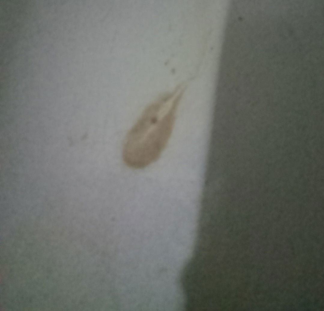 สอบถามค่ะ ตื่นเข้าห้องน้ำตี3 
มีน้ำสีน้ำตาลอ่อนๆ ออกมาแบบนี้เปนไรมั้ยคะคุณแม่ สอบถามผู้รู้ค่ะ