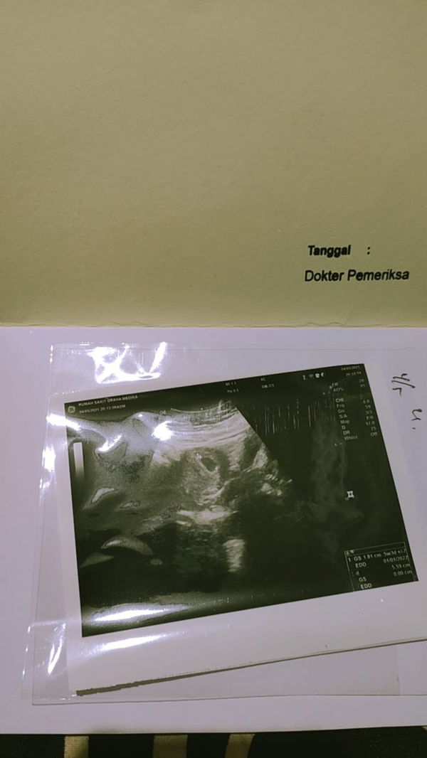 Vrista Ayuk Anggriani profile icon