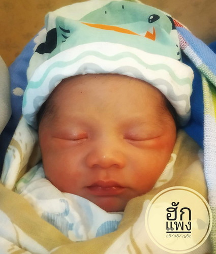 น้องฮักแพงครับผม